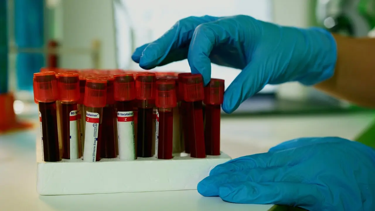 Analize de sânge, noul instrument pentru a prinde leziunile cerebrale grave la timp