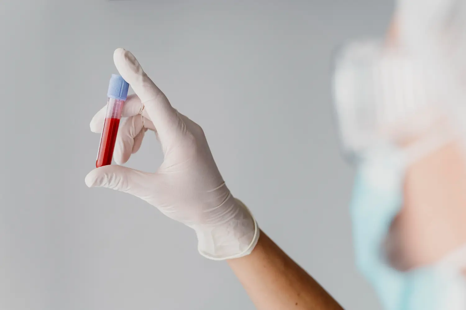 IA prezice riscul de cancer cu ani înainte, pe baza analizelor de sânge