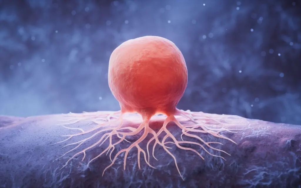 Noi speranțe pentru bolnavii de cancer colorectal: Inteligența Artificială a găsit punctele slabe ale tumorilor!