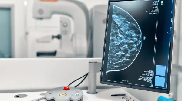 Două teste rapide de două minute estimează riscul de cancer de sân